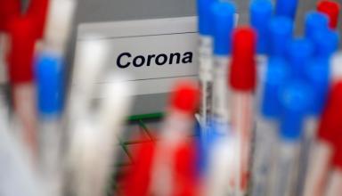 У Львові розпочали високоточне ІФА-тестування на антитіла до коронавірусу