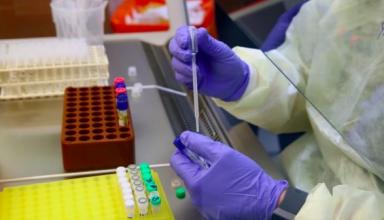 Украина для борьбы с СOVID-19 хочет закупить препарат, которым лечили вирус Эбола